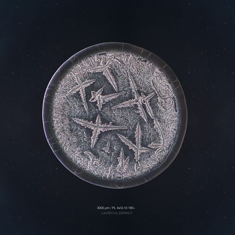 Illustration for article titled The Beautiful Secrets of Tears, Revealed By a Microscope